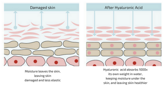 Hyaluronic Acid