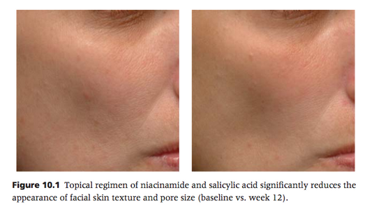 Research - Salicylic Acid and Nicotinamide