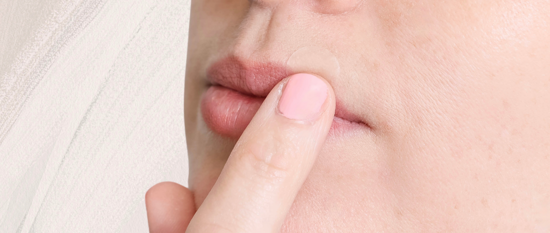 No More Hiding: Your Discreet, Smart Solution to Cold Sore Management 👋