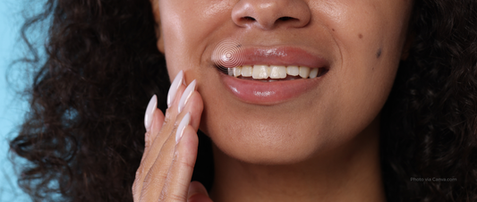 How to Prevent Your Next Cold Sore Outbreak